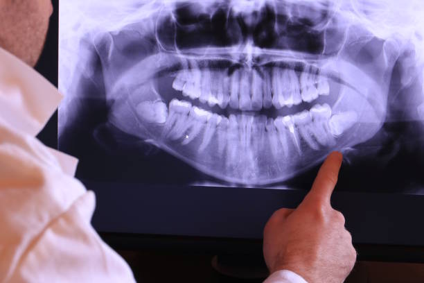 Best Urgent Dental Care for Toothache in Memphis, MI