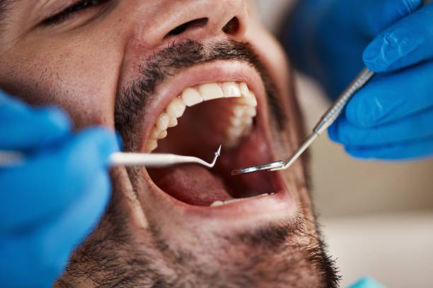 Best Emergency Dental Extractions in Memphis, MI